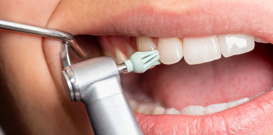 acurata – rotierende Instrumente für dentale Labore und Praxen