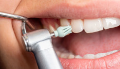 acurata – rotierende Instrumente für dentale Labore und Praxen