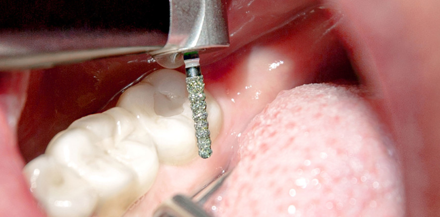 LARRY BLACK – Trennt alle Keramik­werkstoffe leicht und zügig