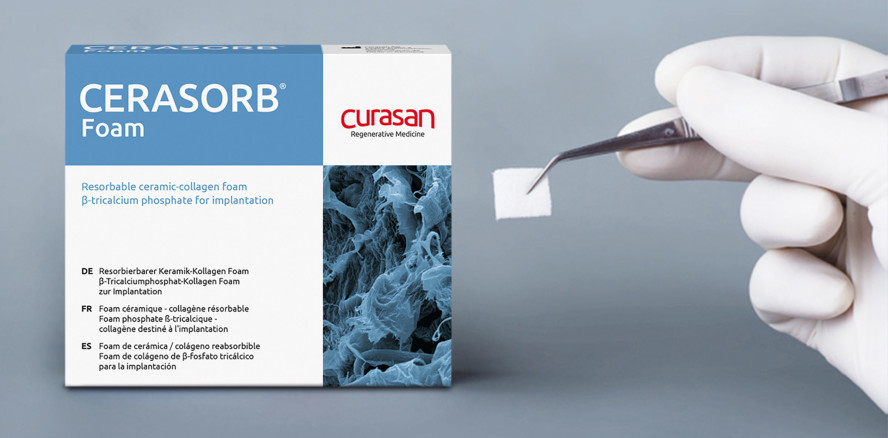 3D-β-TCP-Kollagenmatrix für eine passgenaue Füllung