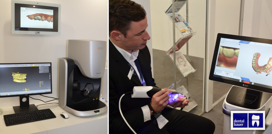 Digitaler Workflow live am Messestand von dental bauer