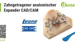 Zahngetragener anatomischer Expander CAD/CAM