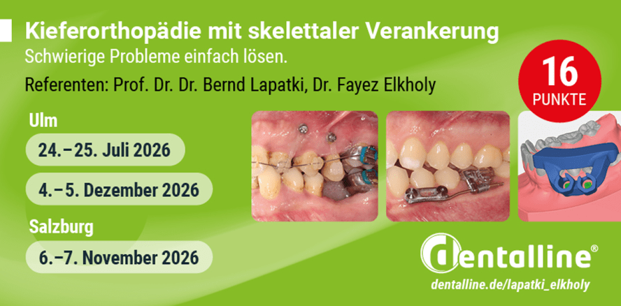 Skelettale Verankerung: Hands-on-Kurs vermittelt Wissen von A-Z