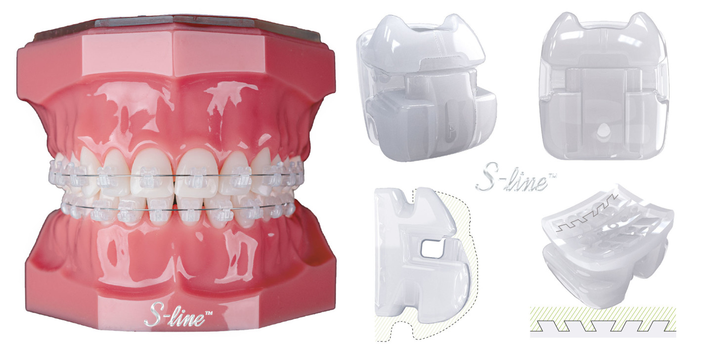 Brackets S-line™ – ästhetisch, komfortabel, effizient