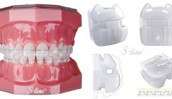 Brackets S-line™ – ästhetisch, komfortabel, effizient