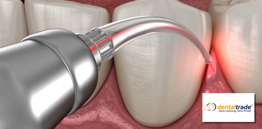 Laserzahnmedizin: Wenn der Zahnarzt zum Lichtschwert greift