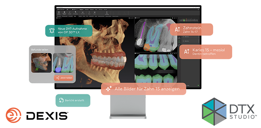 DEXIS setzt neue Maßstäbe in der digitalen Zahnmedizin