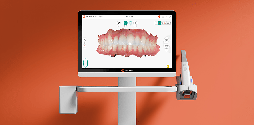 Parallele Datenverarbeitung in der dentalen Bildgebung