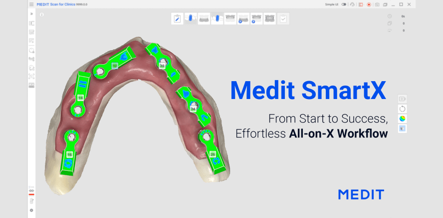 Medit SmartX: revolutioniert den digitalen All-on-X Workflow