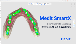 Medit SmartX: revolutioniert den digitalen All-on-X Workflow