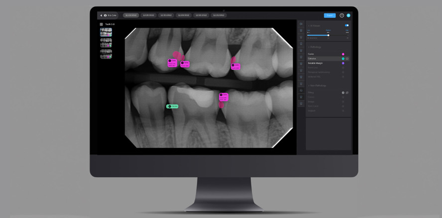 Plandent und Pearl kooperieren bei Ausweitung Europavertrieb
