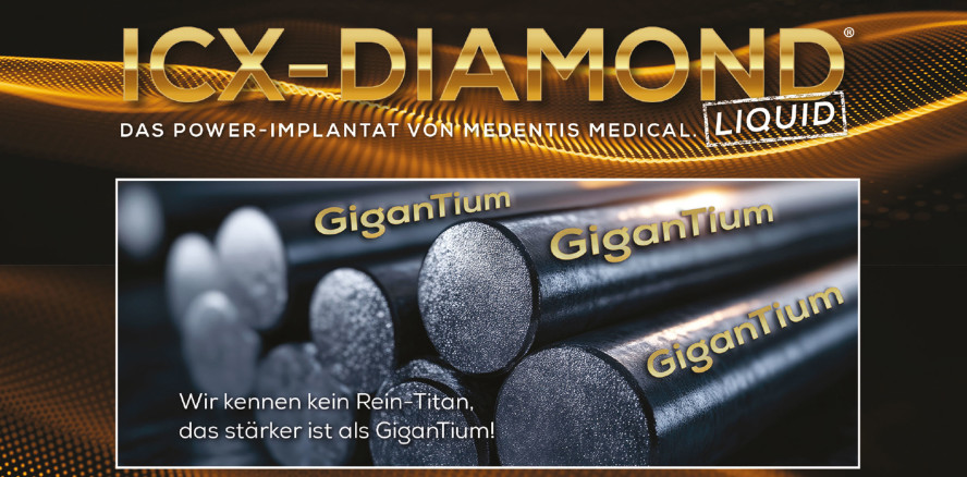 ICX-DIAMOND – das Power-Implantat von medentis medical