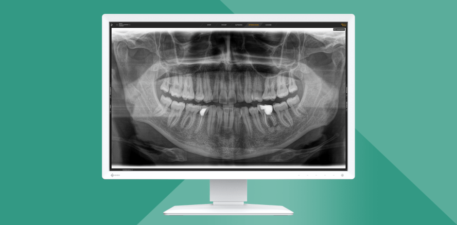 Neu für die Dental-Diagnostik: EIZO RadiForce MX243W-DT