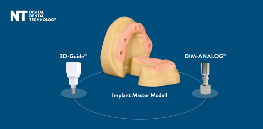 Modernes 3D-Druckverfahren für digitale Workflows