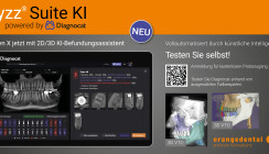 byzz® Suite KI powered by DIAGNOCAT – jetzt integriert in byzz® Nxt