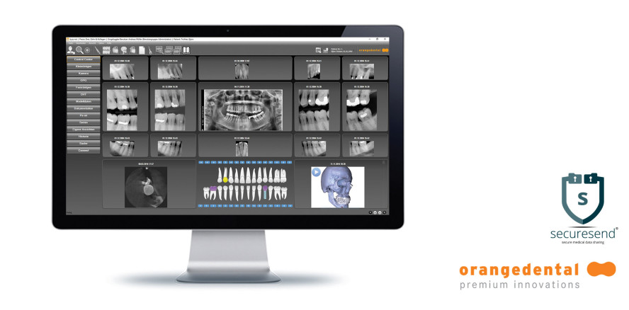 byzz®nxt TransCrypt ermöglicht sicheren Austausch sensibler Daten