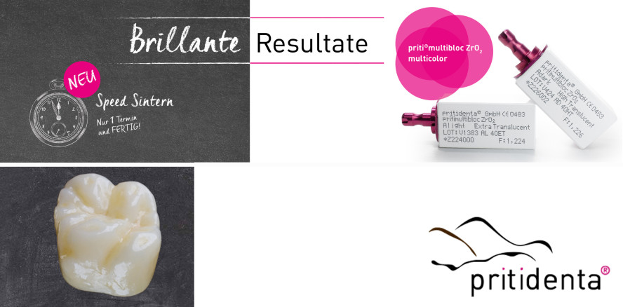 Jetzt auch Extra Translucent: priti® multibloc ZrO2 von pritidenta