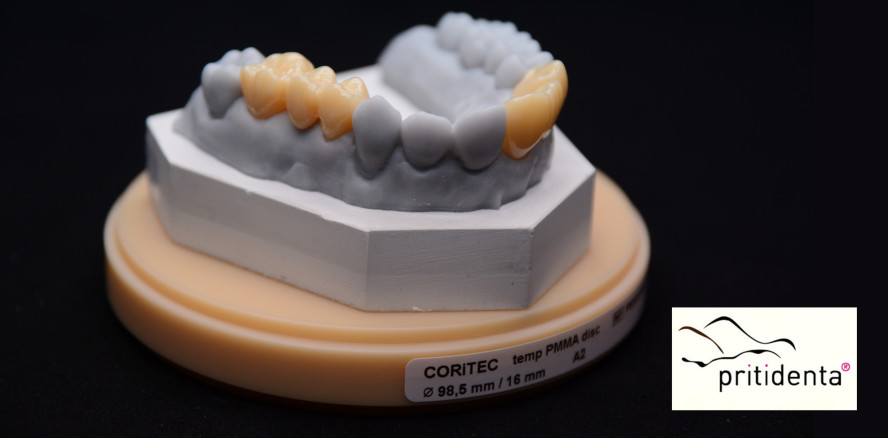 Neu bei pritidenta: CORiTEC Materialien für Schienen und Langzeitprovisorien