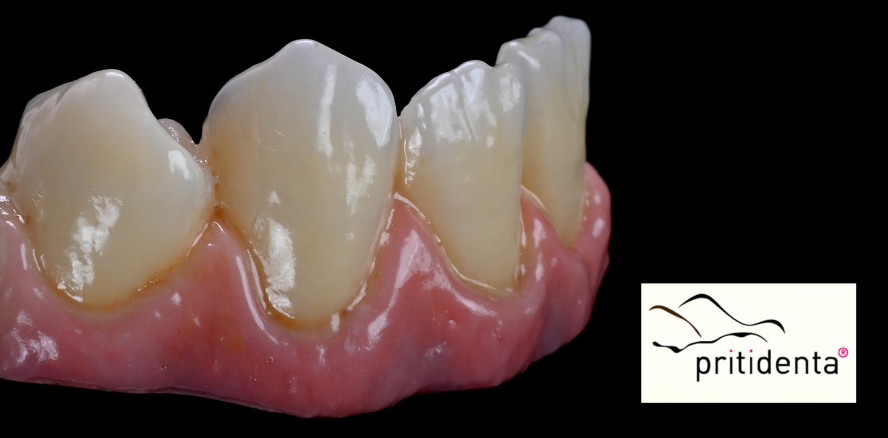 priti®perfect – Perfect Malen mit 20 Komponenten