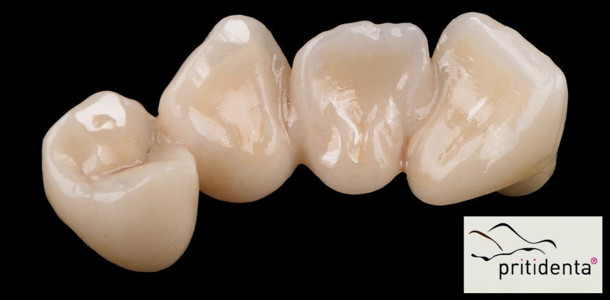 Echtes Multi-Talent mit zwei Zirkon-Qualitäten