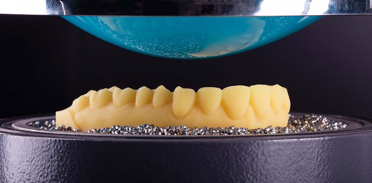 3-D-Druck in der Dentaltechnologie: Anforderungen an die Werkstoffe und Prozesse