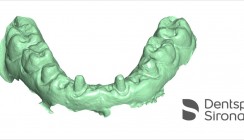 CEREC jetzt noch flexibler: Offener Scan-Export