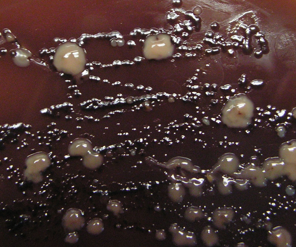 Anaerobe Mischkultur aus dem Sulkus bei Pubertätsgingivitis.