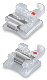 SensationTM-Keramikbracket (Fa. Ortho Technology).