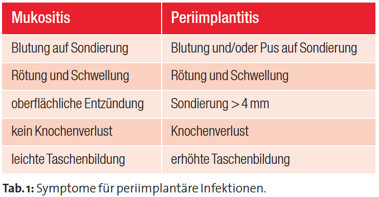 Tabelle Liebaug Periimplantitis