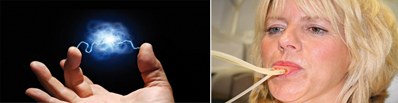 Abb. 1: Anschauliche Darstellung der Plasmawolke. – Abb. 2: Patientin mit FMT während der Full Mouth Disinfection.
