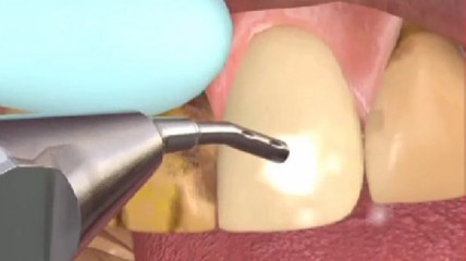 Sylc - Das neue Reinigungpulver