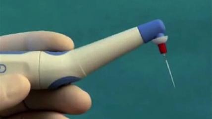 EndoActivator