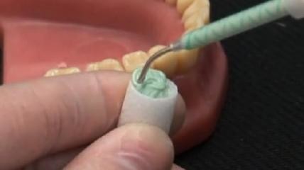 Centrix GingiTrac MiniMix