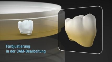 Kuraray: Zirconia ML Master (Deutsch)