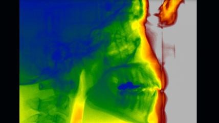 VGi evo gewährt gestochen scharfe Einblicke