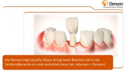 Denseo HiQ Glasur für den optimalen Schutz der Keramik-Krone