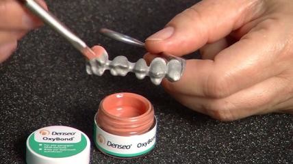 Denseo OxyBond für ästhetische Höchstanforderungen