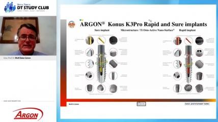 Argon Webinar: 3-D-Augmentation mit simultaner Implantation
