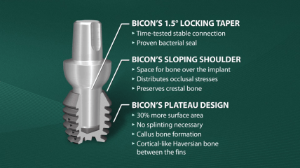 Einführung in die Bicon SHORT® Implants