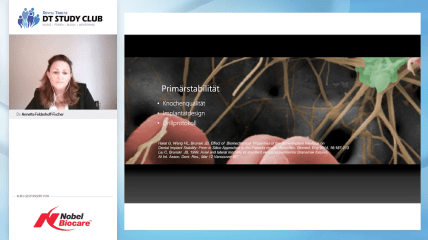 Nobel Biocare Webinar: Mehrwert von Guided Surgery