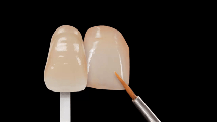 VITA AKZENT® Plus CHROMA STAINS Video Tutorial