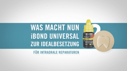 Intraorale Reparaturen mit iBOND Universal von Kulzer