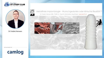 Webinar des Monats: Metallfreie Implantologie – Wunschgedanke oder klinische Realität?
