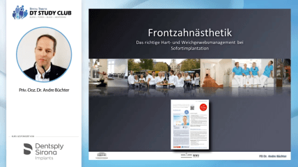 Webinar des Monats: Das richtige Hart- und Weichgewebemanagement bei Sofortimplantation