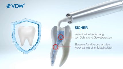 EDDY®: Die schallaktivierte Spülinnovation – eine Lösung mit drei Vorteilen