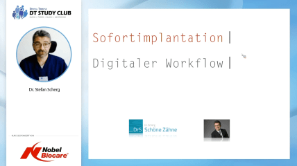 Nobel Biocare Webinar: Digitaler Workflow bei Sofortimplantation