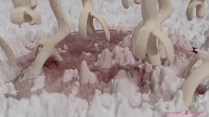 Osseointegration des BioWin! Keramik-Implantates
