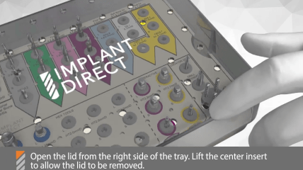 Anwendung des Chirurgie-Kit zum InterActive System von Implant Direct