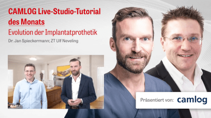 CAMLOG LIVE-Tutorial „Evolution der Implantatprothetik“ (Teil 1)