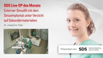 Video der SDS Live-OP zum externen Sinuslift
